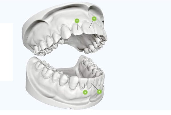 Une capture d'écran représentant un prototype d'une mâchoire en 3D interactive destiné à la formation professionnelles de prothésistes dentaires.